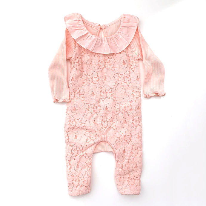 Lace onesie